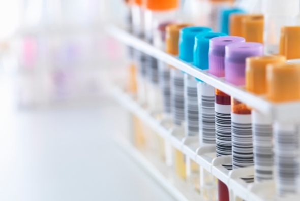 B64DA09B-3A53-4B77-A793ADF41B41F461