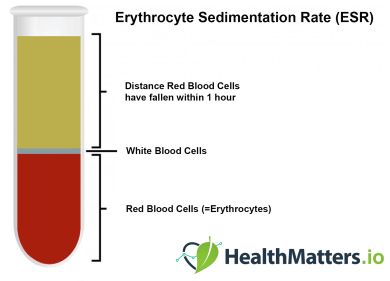Erythrocyte Sedimentation Rate (ESR)