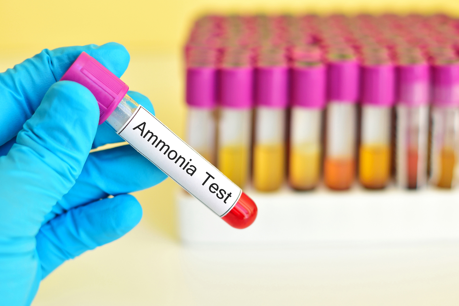 ammonia blood test