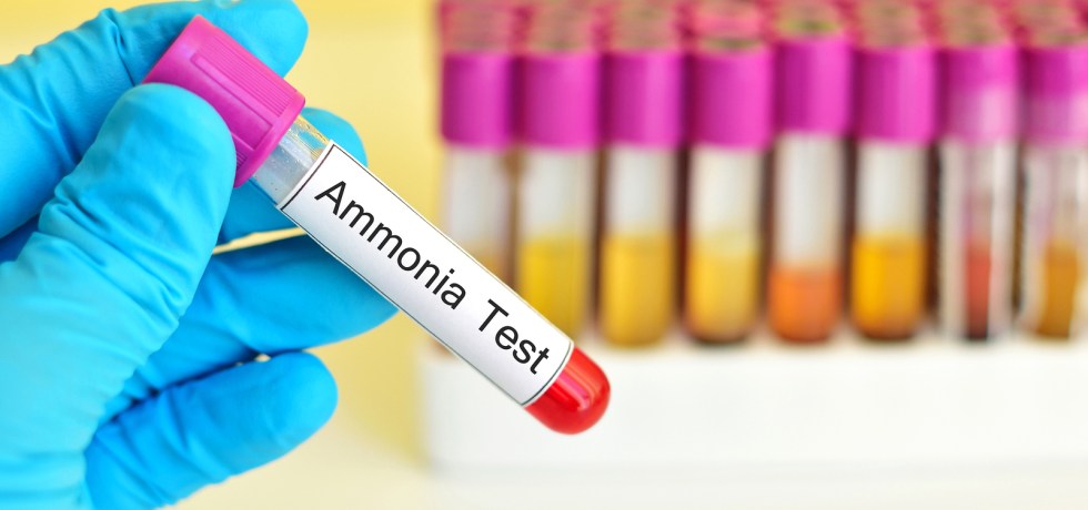 ammonia blood test