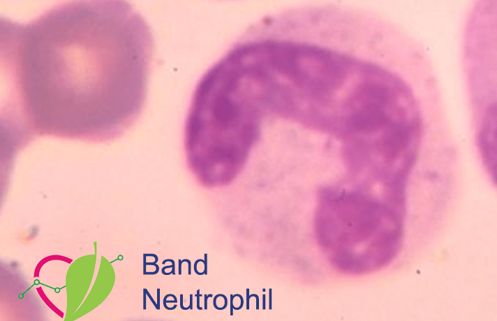band neutrophils