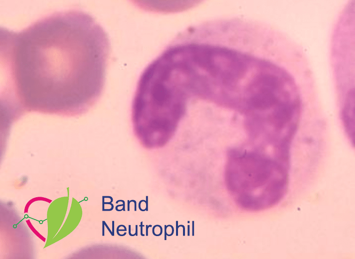 band neutrophils