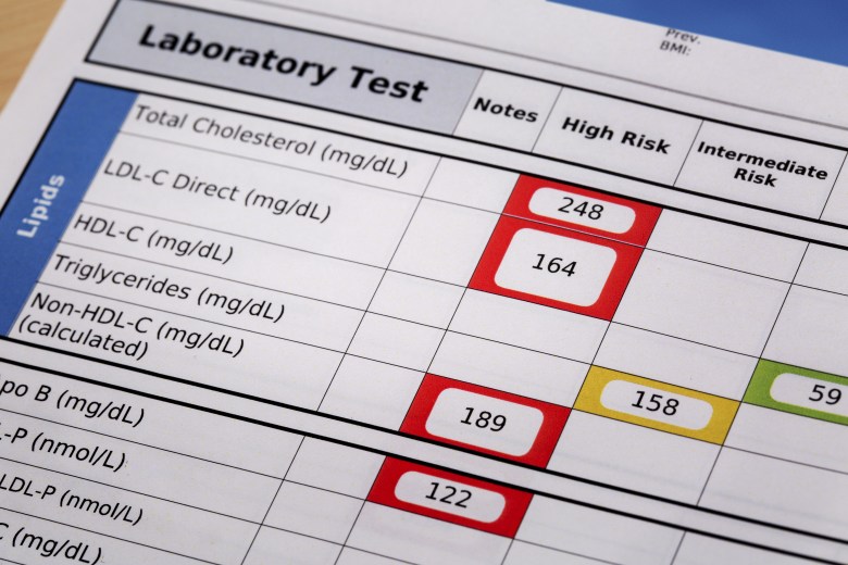 cholesterol high low ldl hdl vldl triglycerides