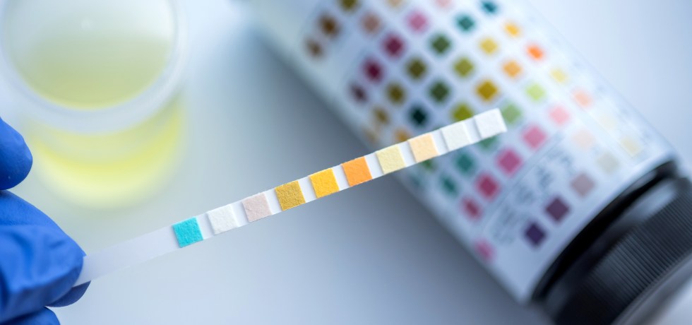 Hyaline Cast high low meaning