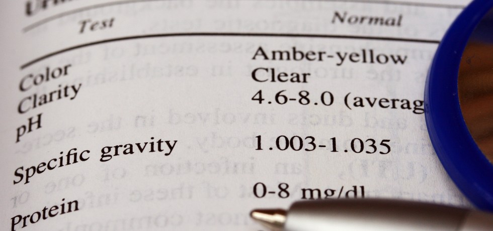 low urine specific gravity