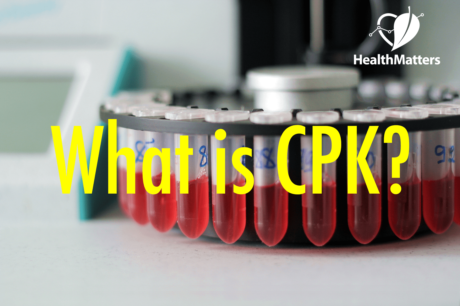 what is Creatine phosphokinase (CPK) high low
