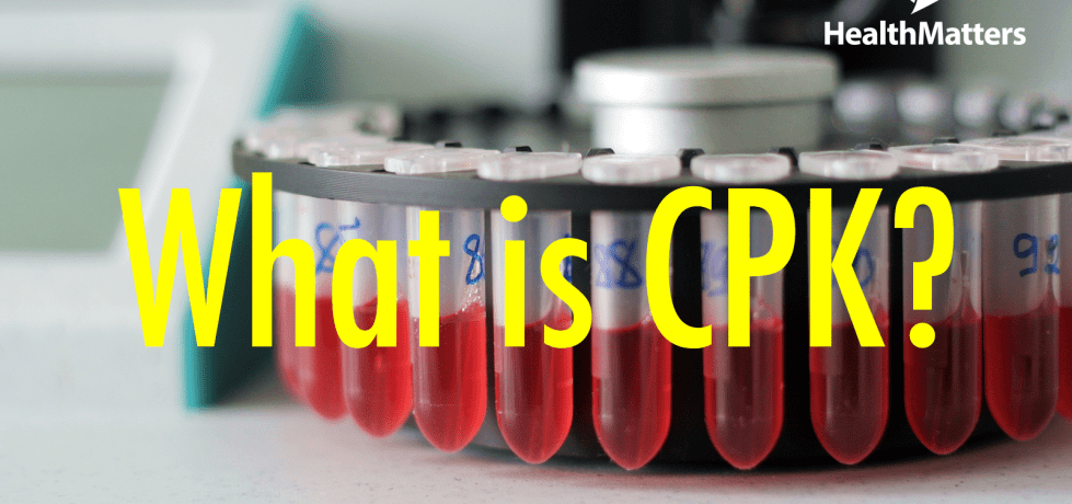 what is Creatine phosphokinase (CPK) high low