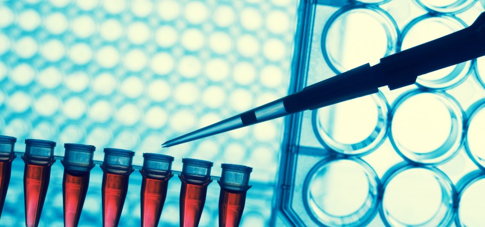 HealthMatters.io Iron Panel Test TIBC UIBC Ferritin Transferrin Iron Serum levels normal anemia