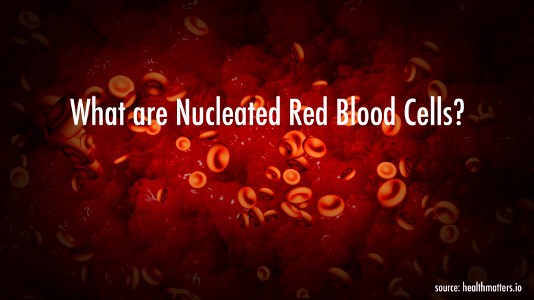 What are Nucleated Red Blood Cells (NRBC)