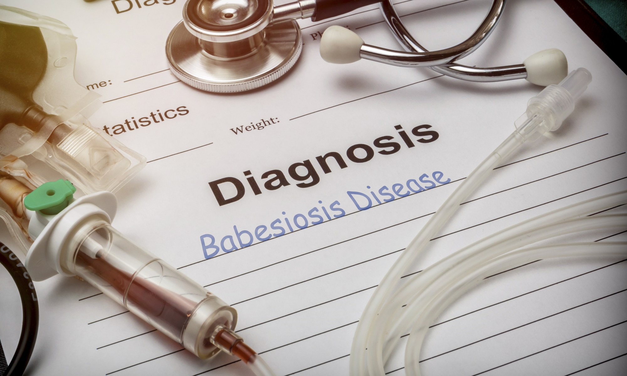 Babesiosis Babesia microti, IgG diagnosis high low meaning tick lyme