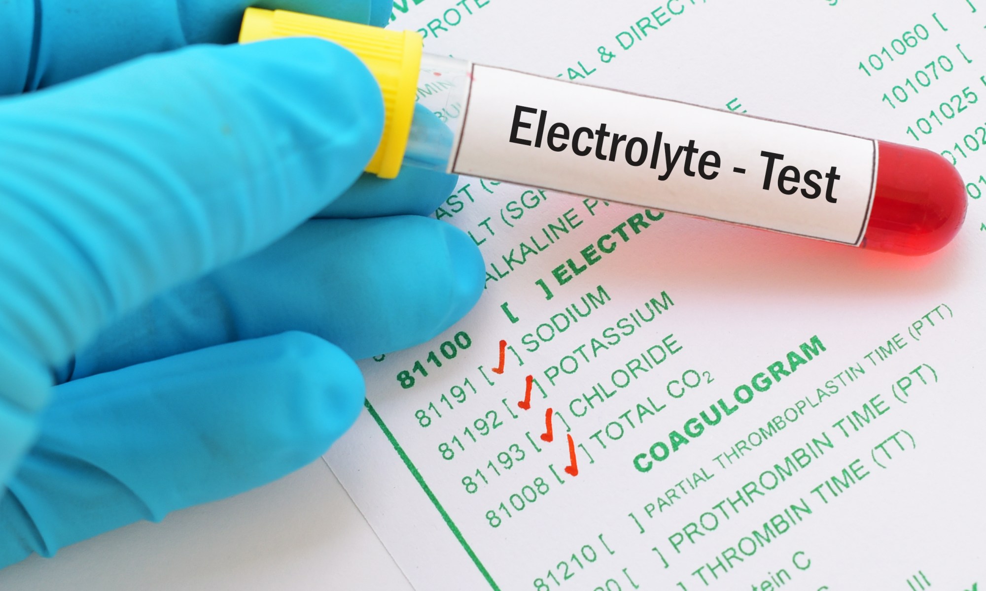 What is Chloride? low high meaning