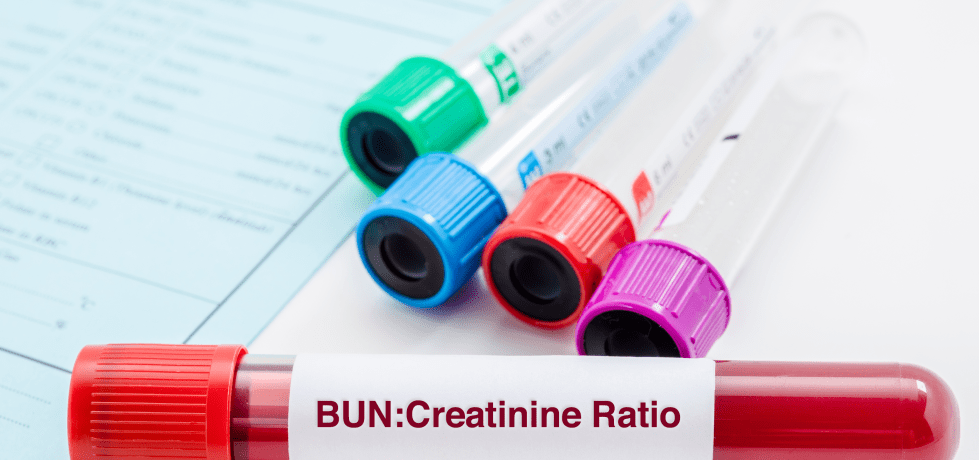 blood urea nitrogen creatinine ration meaning high low reference value definition