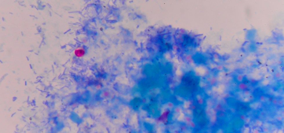 Cryptosporidium high low meaning