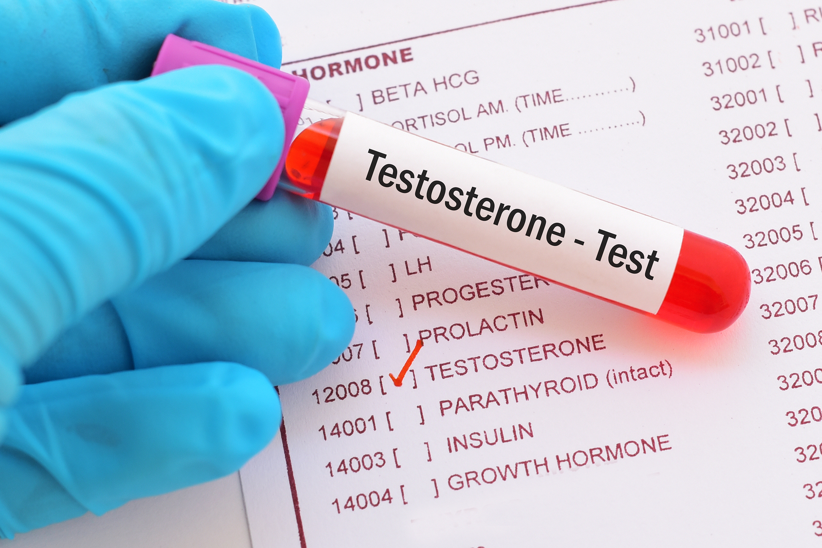 female testosterone high low meaning treatment symptoms