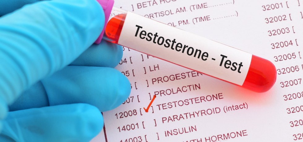 female testosterone high low meaning treatment symptoms