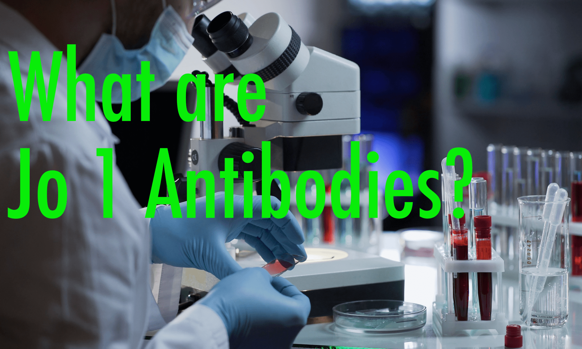 what are Jo 1 Antibodies?
