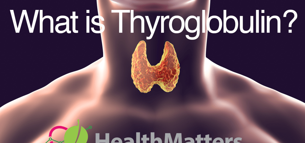 thyroglobulin high low meaning