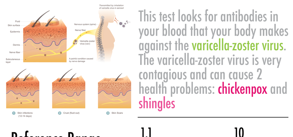 varicella-zoster chickenpox shingles antibody igg test meaning results high low
