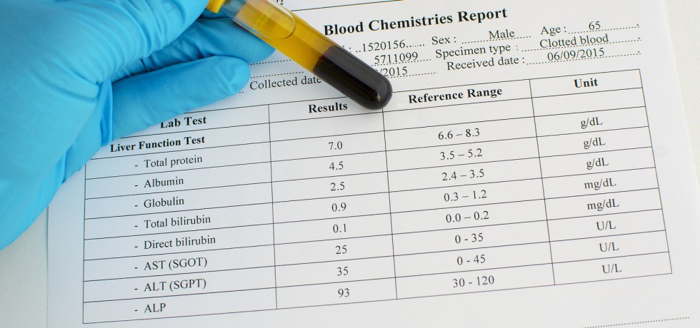 GGT ALP AST ALP Liver test normal results meaning