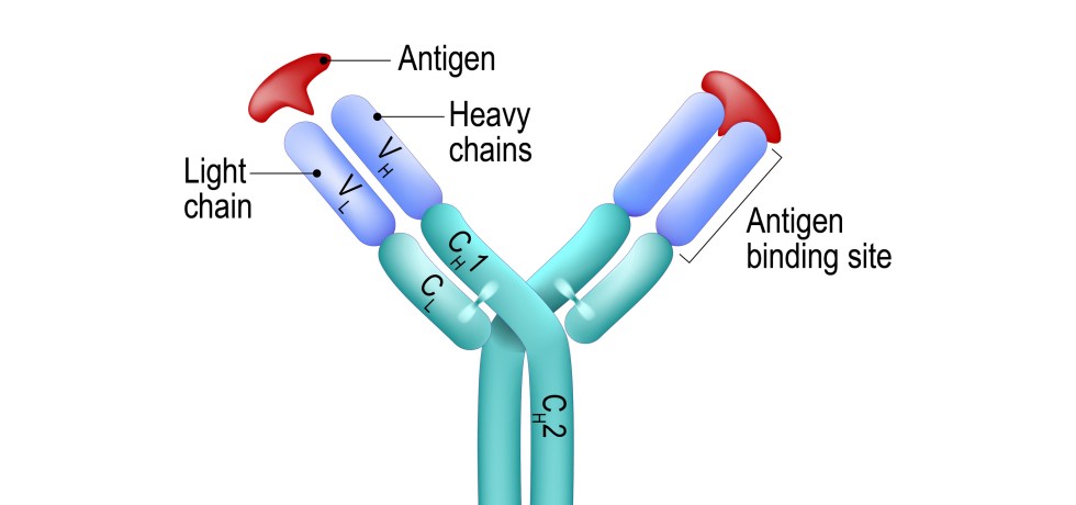 Free Lambda Light Chains high low meaning treatment result test