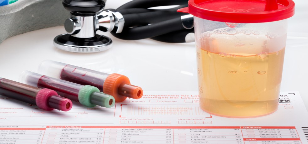 Leukocyte esterase UTI Treatment high low meaning ranges