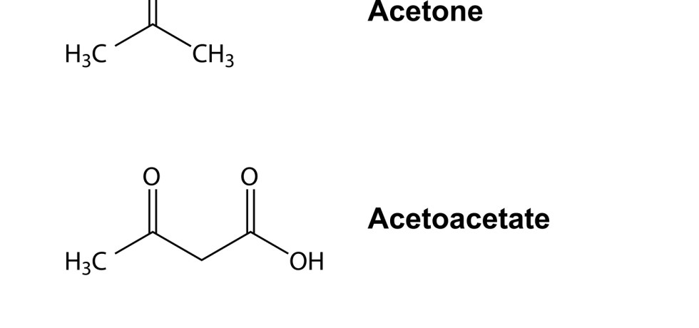 Beta-Hydroxybutyrate high low meaning ketosis genova treatment