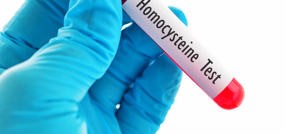 Homocysteine high meaning treatment