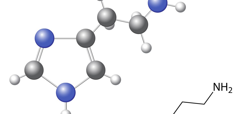 histamie urine high low meaning treatment interpretation what does it mean?