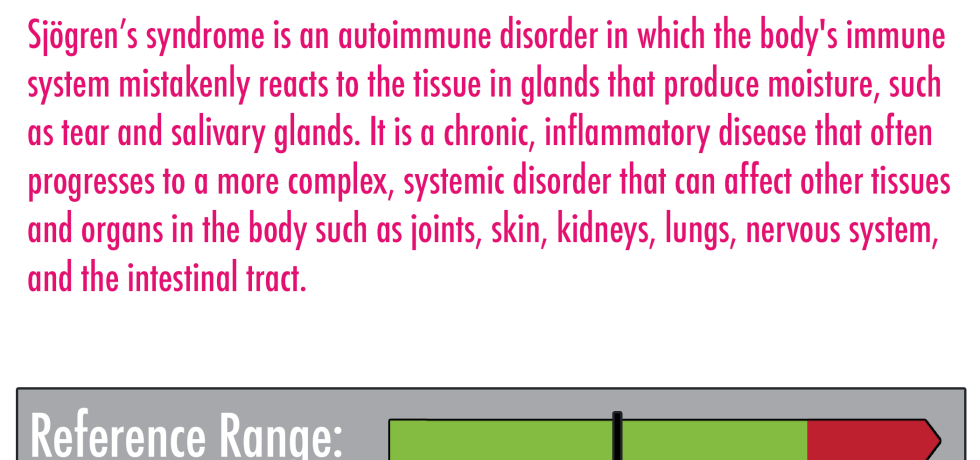 sjogren's syndrome high low results meaning treatment symptoms interpretation