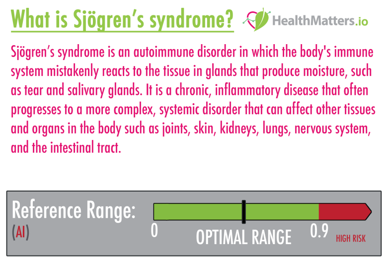 sjogren's syndrome high low results meaning treatment symptoms interpretation