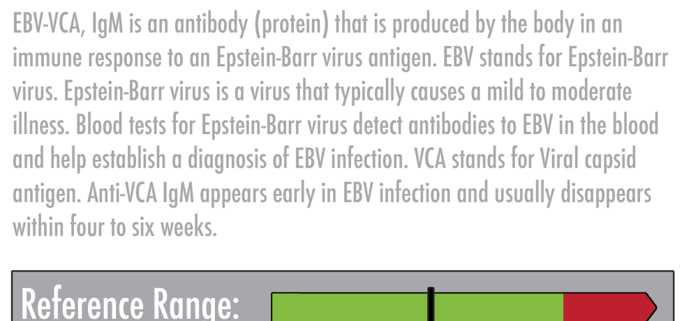 EBV Ab VCA, IgM epstein barr high low meaning treatment